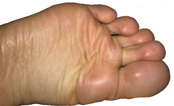 What are the health benefits of going barefoot
